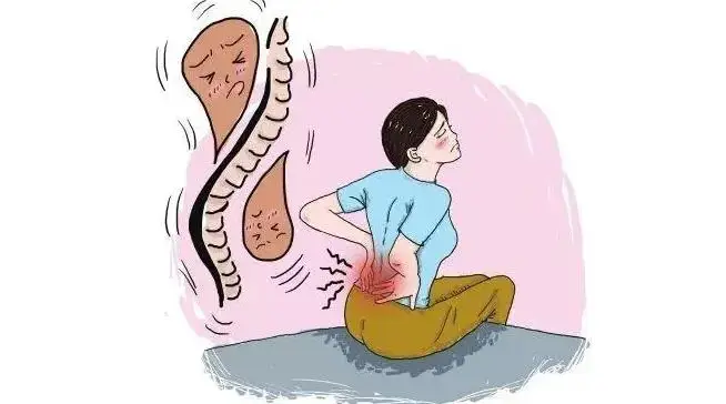 震驚！原來這些小習(xí)慣竟然可以預(yù)防腰突…