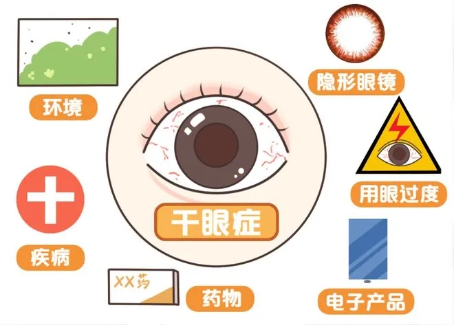 干眼癥是“絕癥”嗎？