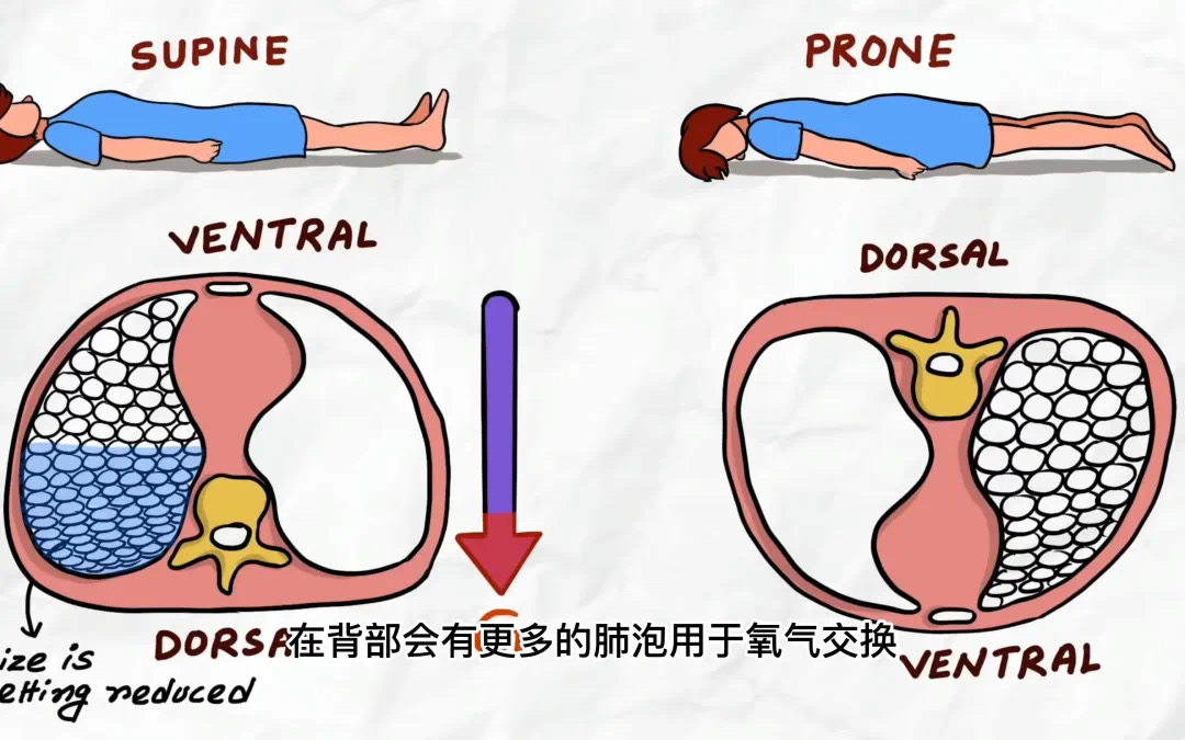 換個姿勢睡覺，竟然可以救命