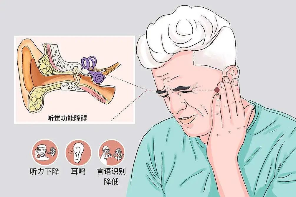 突襲的寂靜——突發(fā)性耳聾，72小時(shí)內(nèi)必須就醫(yī)的耳科急癥